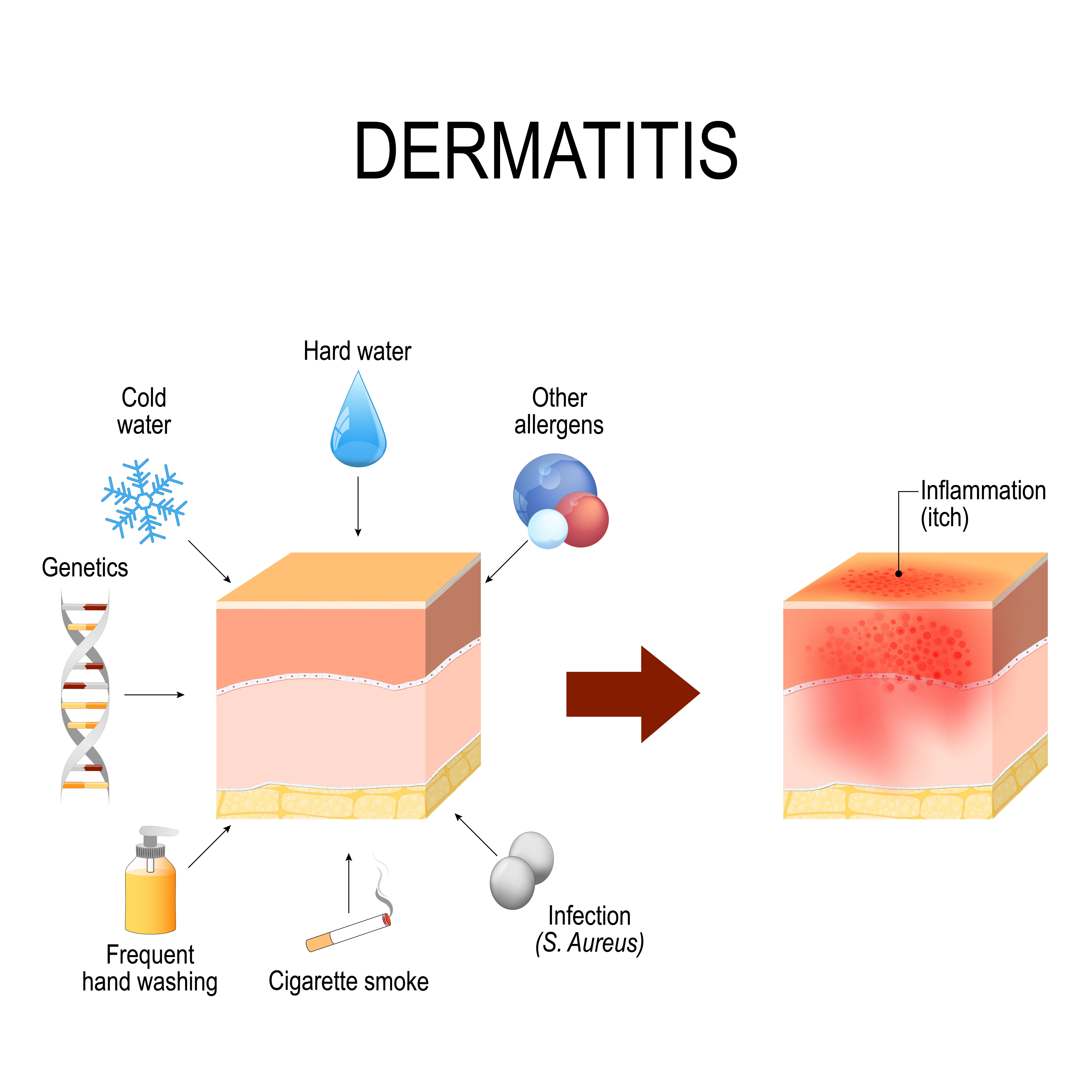 Patch test