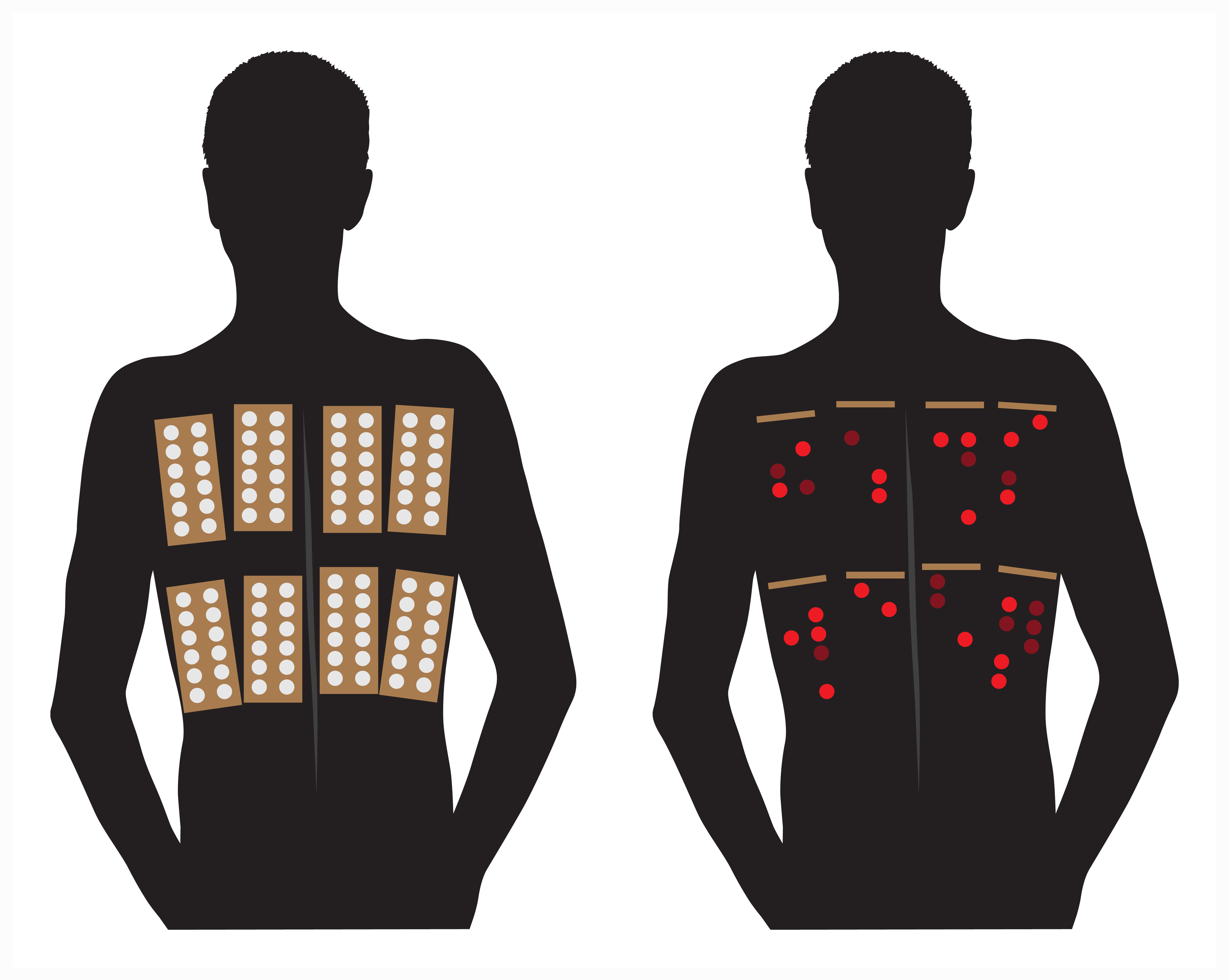 Allergy skin test