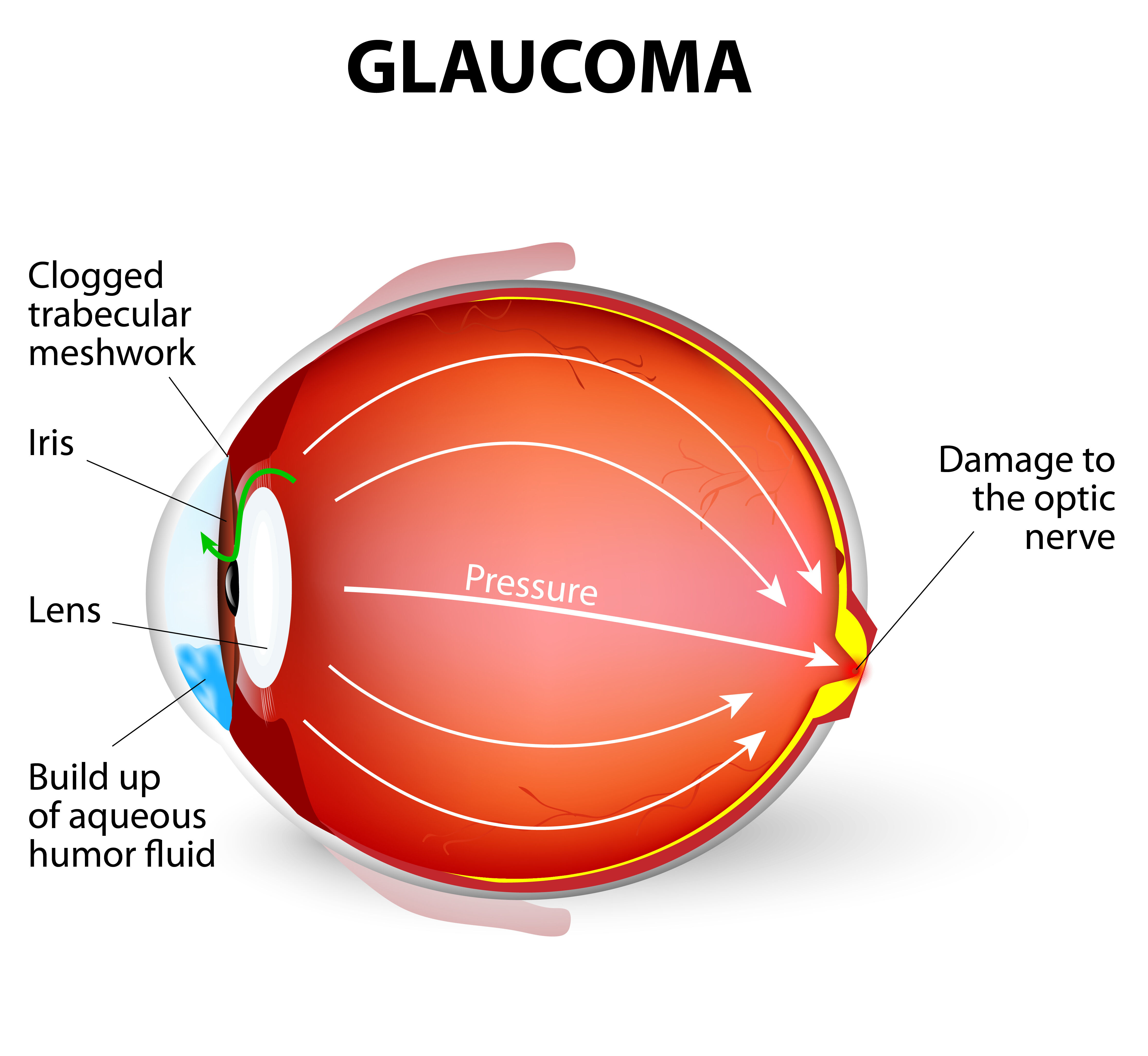 What are vitamin b12 deficiency and vision problems?