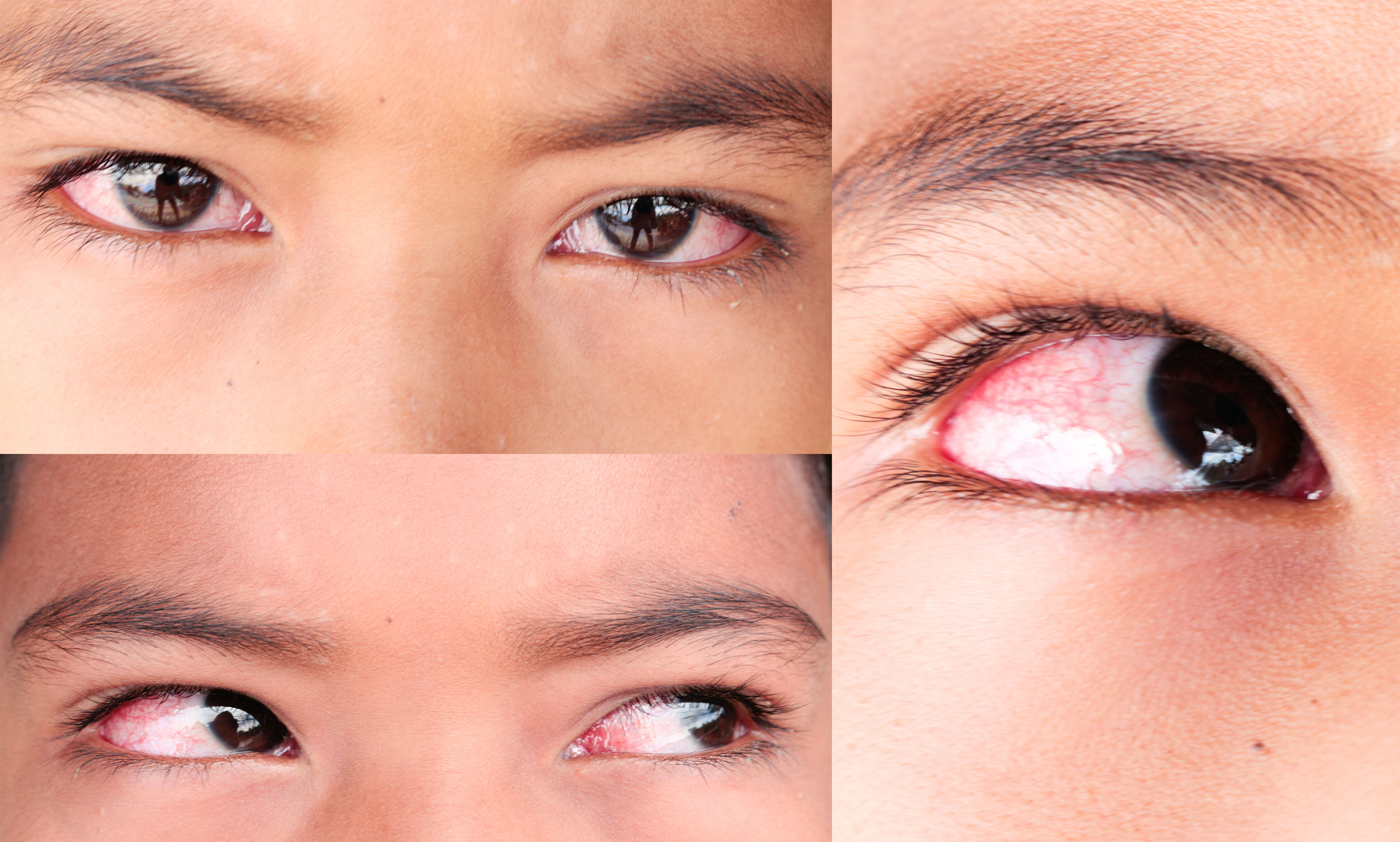 patients with ocular abnormalities