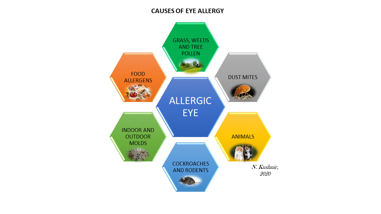 What Are Eye Allergies Symptoms Diagnoses And Treatment 