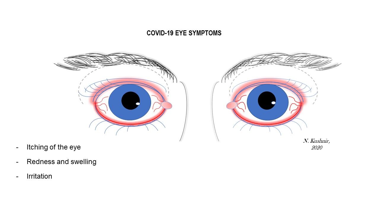 COVID eye symptoms 